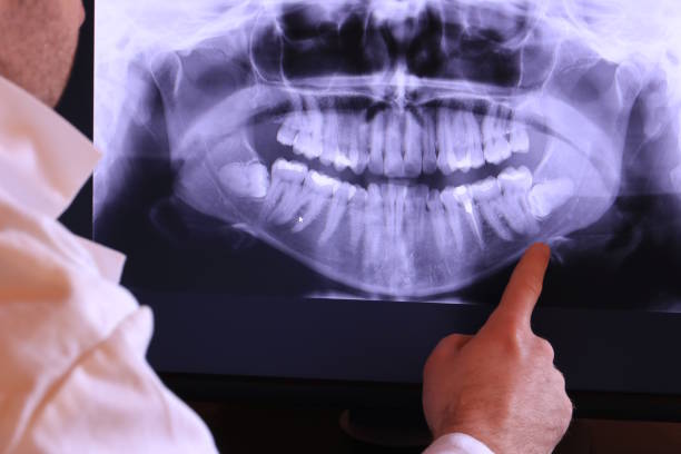Best Dentist for Severe Toothache  in Uhland, TX